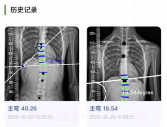 筠成矫形v1.1.7截图