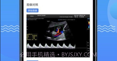超声智库v1.2.31截图