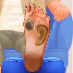 修脚足疔模拟器高画质版