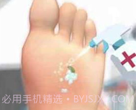 修脚模拟器v2.6截图