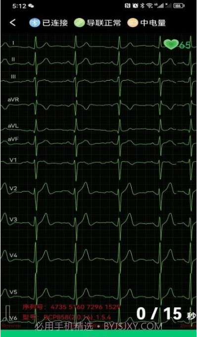 心电一张网截图2