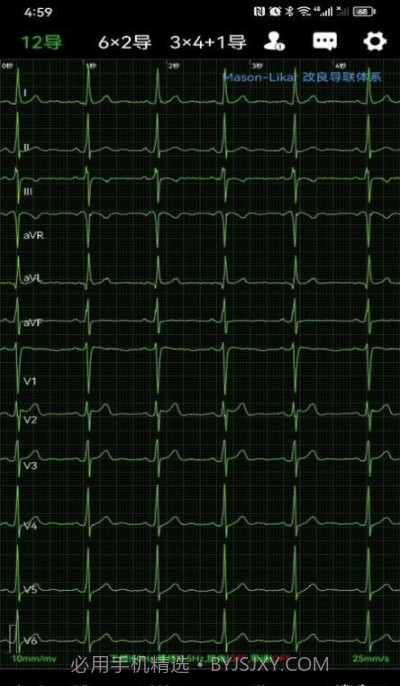 心电一张网截图4
