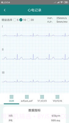 及时心电截图2 及时心电截图2