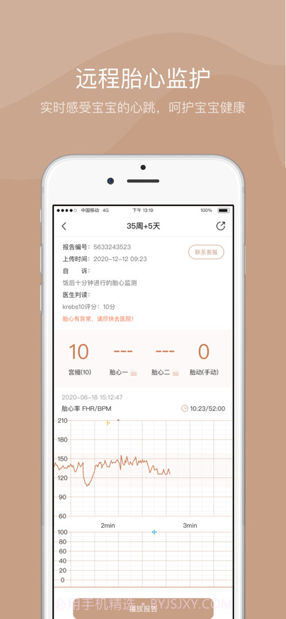 智胎心截图2 智胎心截图2