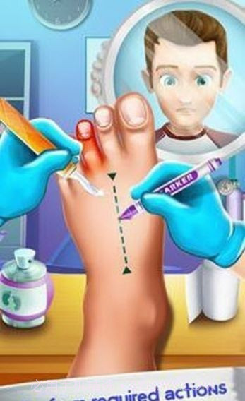 甲沟炎修脚解压截图1