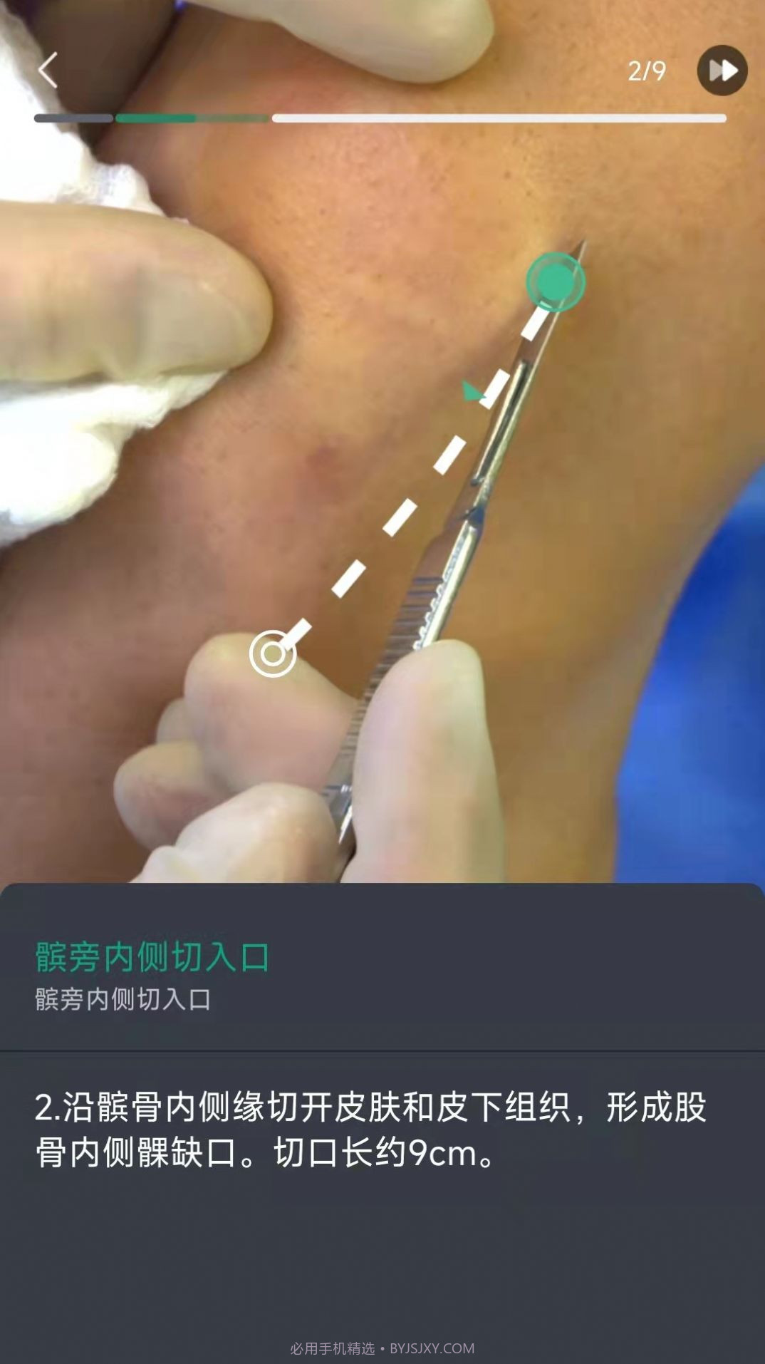 万康人体解剖截图1 万康人体解剖截图1