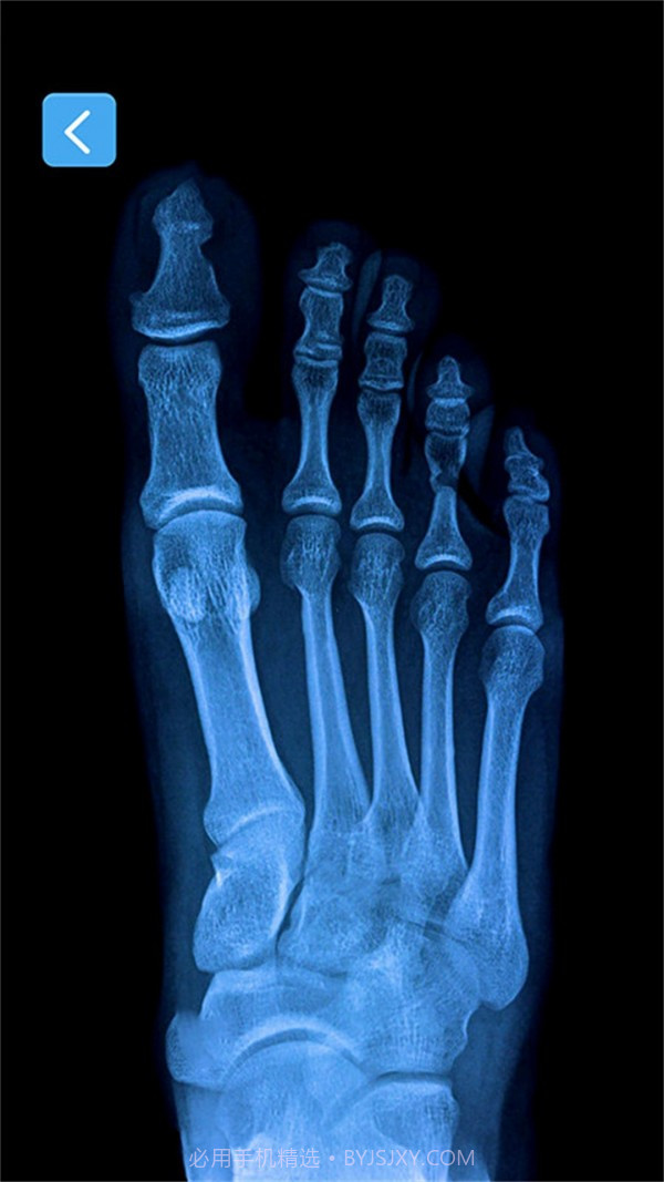 X射线模拟器截图2 X射线模拟器截图2