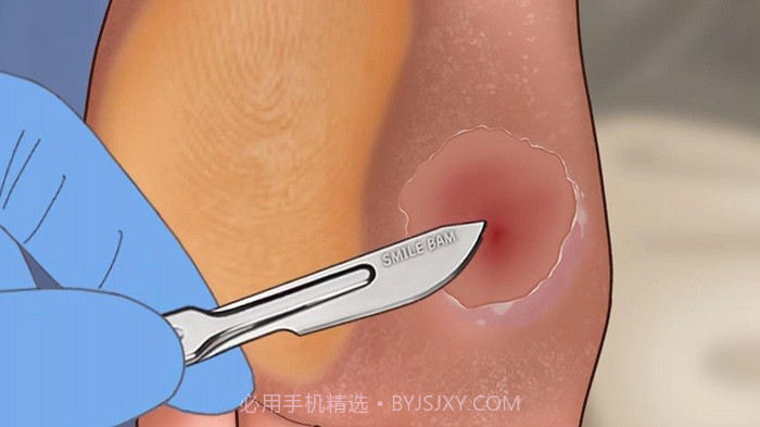 修脚足疔模拟器精简版截图3