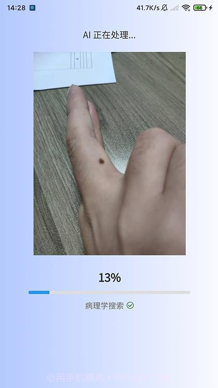 医用皮肤镜影像处理软件定制版截图1 医用皮肤镜影像处理软件定制版截图1